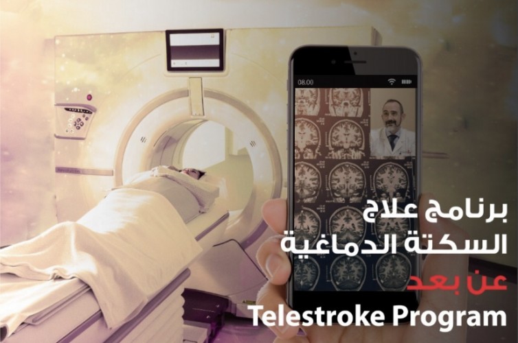 “مستشفى الحبيب” تطلق خدمة لعلاج الجلطات الدماغية السريع عن بُعد