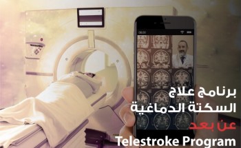 “مستشفى الحبيب” تطلق خدمة لعلاج الجلطات الدماغية السريع عن بُعد